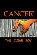 Click HERE for CANCER THE CRAB BOY